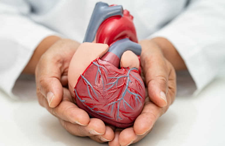 CVD and Hypertension Management A person holding a detailed human heart model with visible veins and arteries.