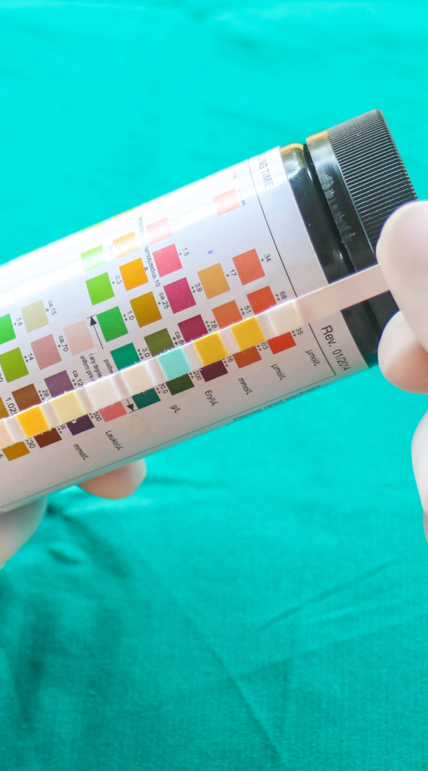 Urinalysis and Associated Infections Hand holding a colour chart for testing pH levels.