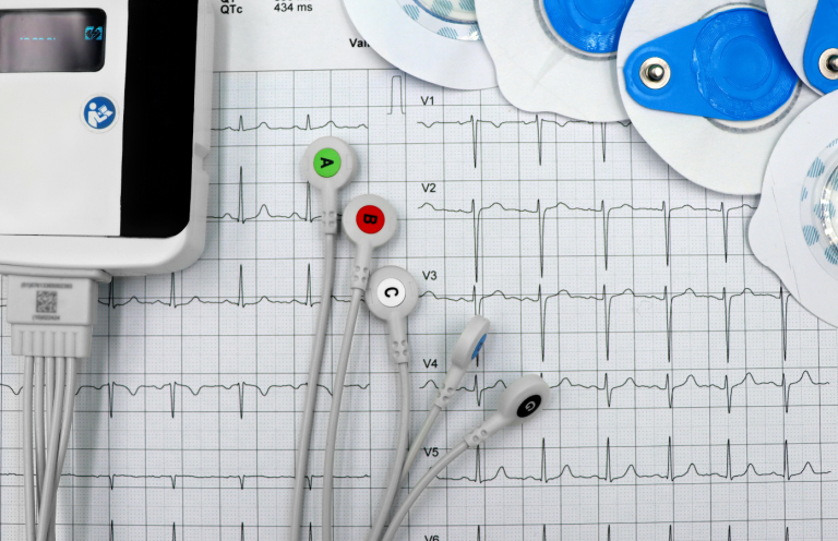 Foundation ECG Training ECG electrodes on a medical monitor with paper printout in the background.