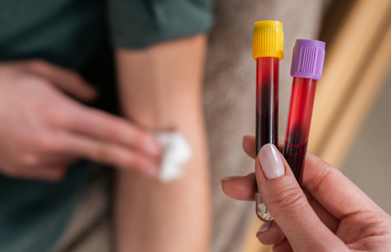 Venepuncture (Phlebotomy) Training A hand holding two blood sample tubes next to a person's arm with a cotton ball.