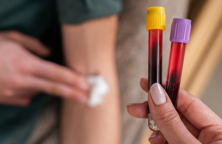 Venepuncture Training A hand holds two blood sample tubes next to an arm with an antiseptic wipe.