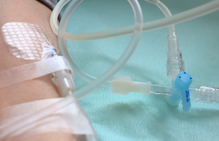 Medical IV setup with tubing connected to an arm with a bandage.