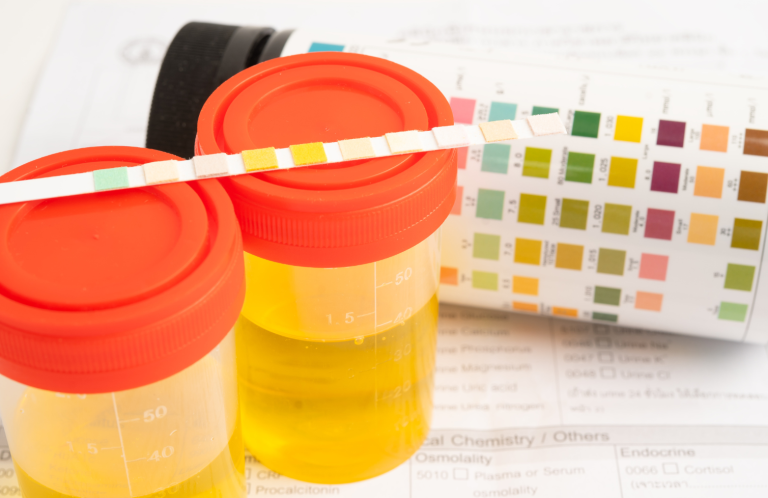 UTI Awareness Training Two urine sample containers with a colour chart and test strips on a document.