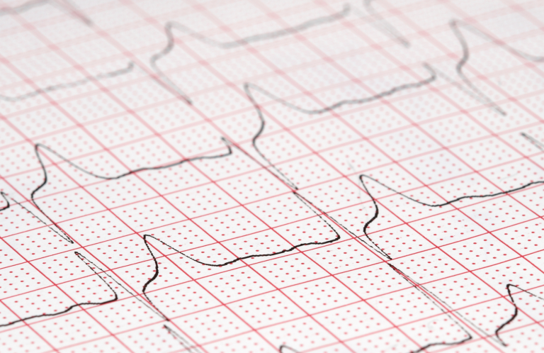Medical instruments including a stethoscope and pen-like devices on a light background.