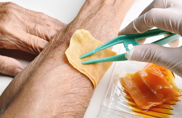 Wound Care Awareness and Pressure Area Care A hand applying a dressing to an elderly person's arm.