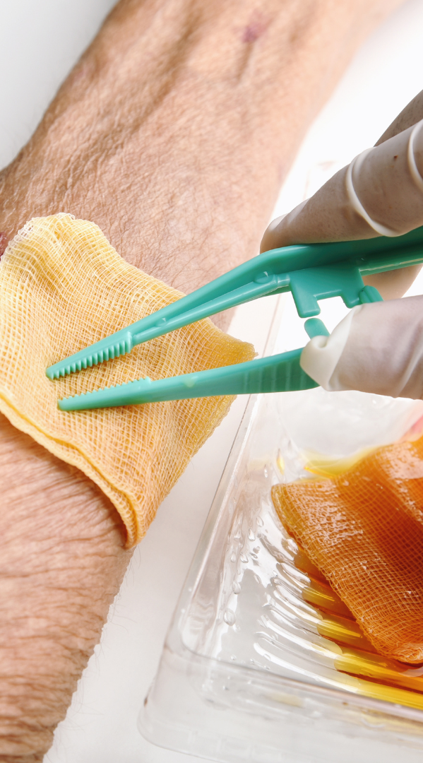 A healthcare professional using tweezers to handle a sterile dressing on a patient's arm.