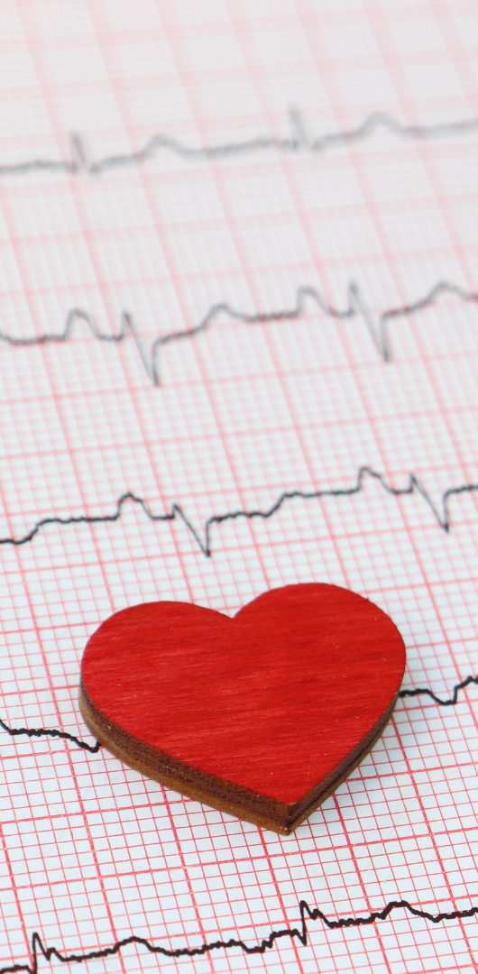 Electrocardiograph (ECG) Update Training Red heart shape placed on an electrocardiogram chart.